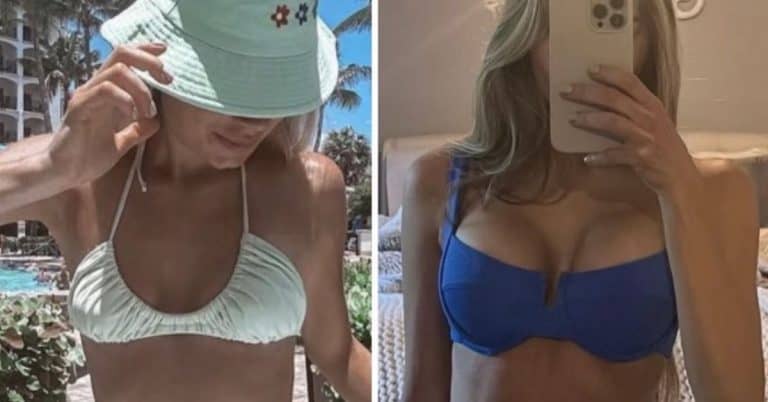 Breast Augmentation: 5 Before & After Photos That Prove The Natural Look Is In