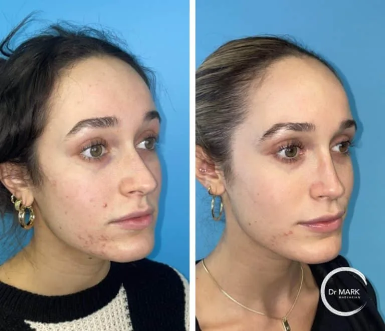 Patient 2, 6 months post-op, view 5