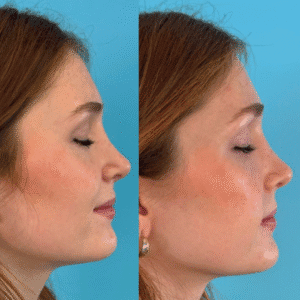 Beige Minimalist Skincare Before and After Instagram Post (2)