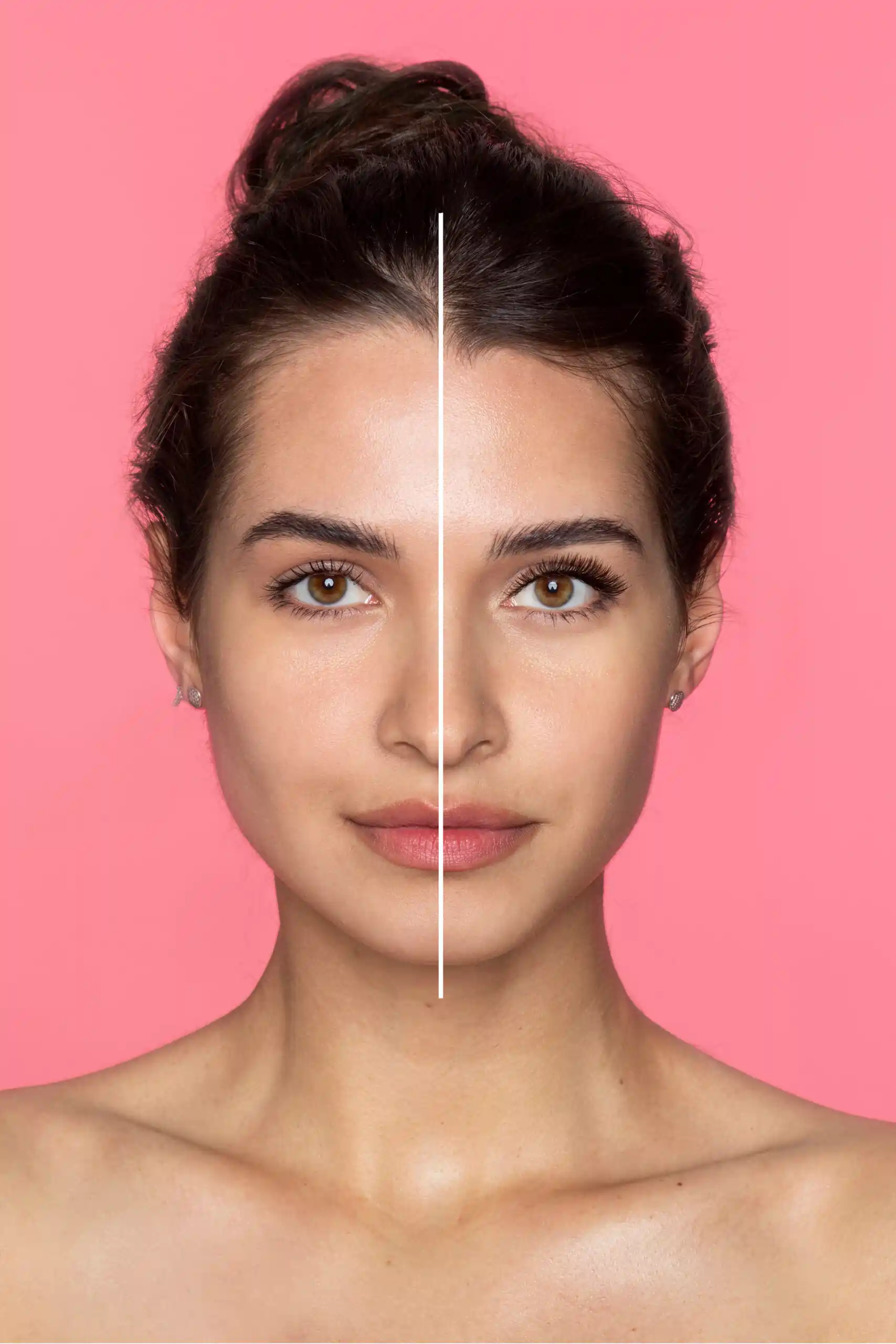Face and Rhinoplasty