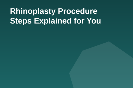 Rhinoplasty procedure steps guide graphic